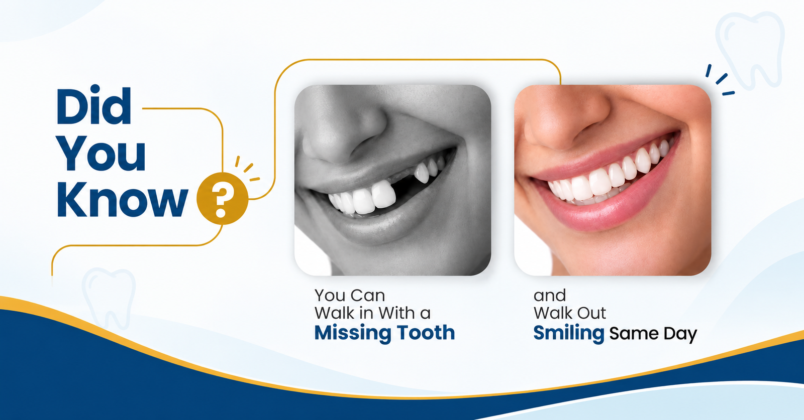 Affordable Treatment Options with the Best Dentist in Mohali