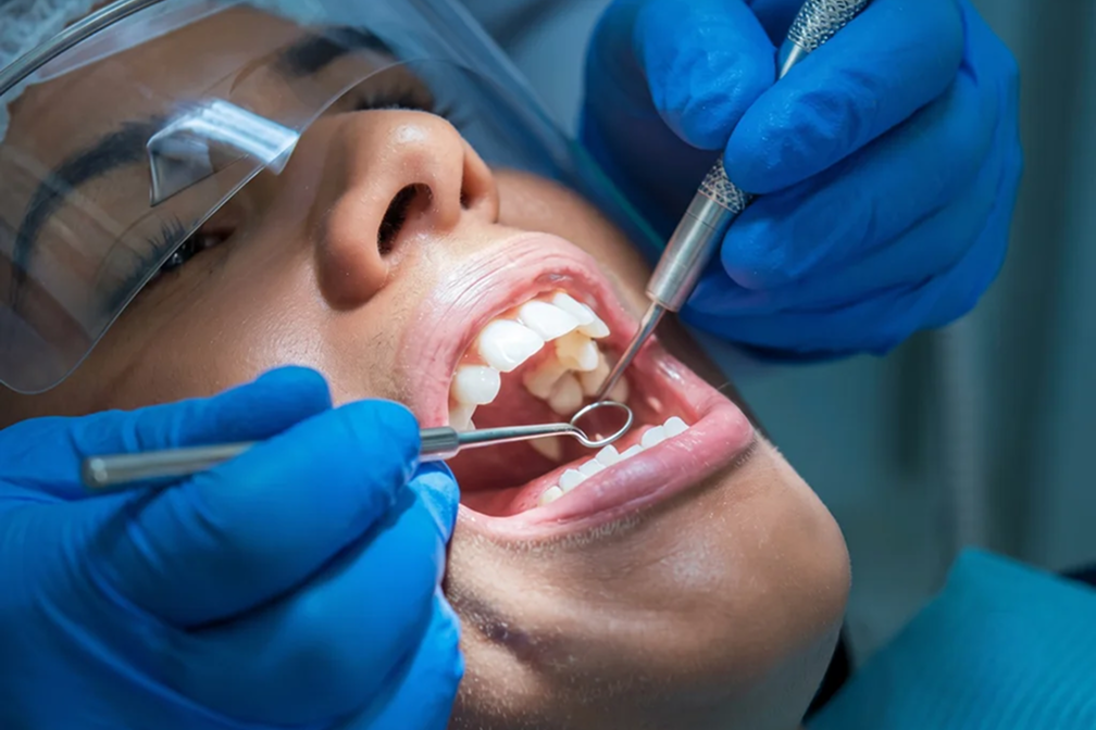 What Happens During a Dental Cleaning?