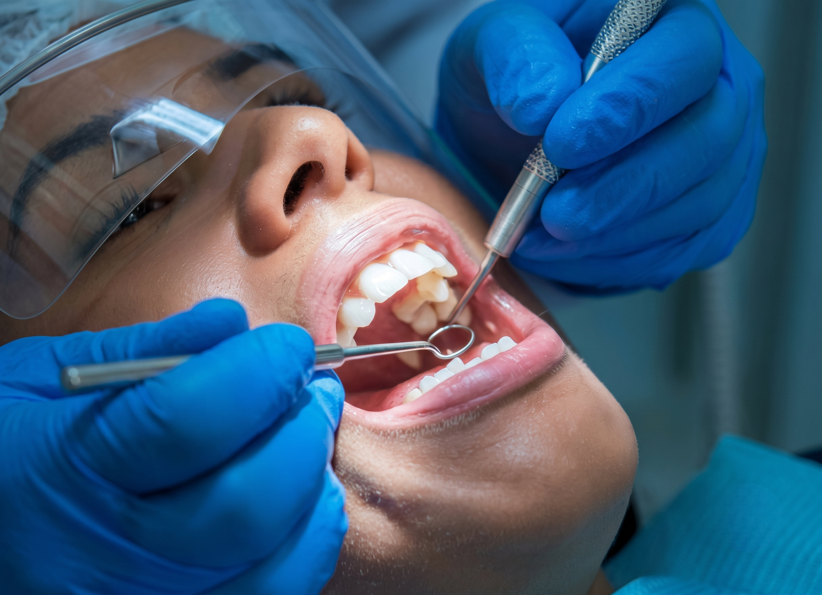 What Happens During a Dental Cleaning?