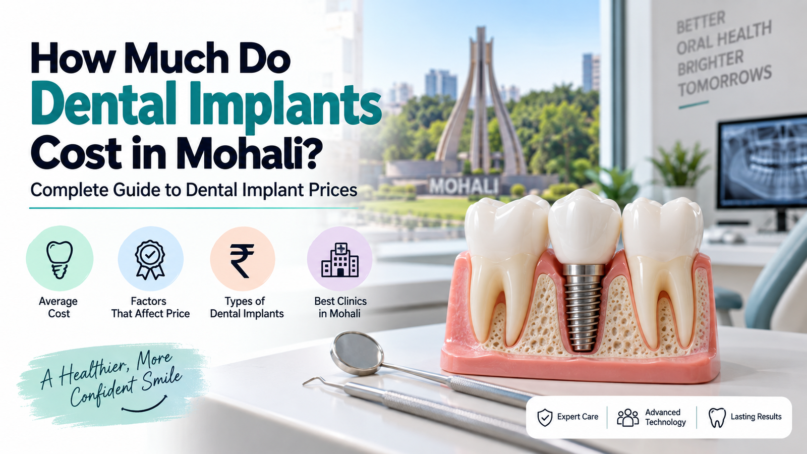 How Much Do Dental Implants Cost in Mohali? Complete Guide to Dental Implant Prices