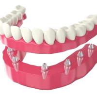 Top Qualities to Look for in the Best Dentist in Chandigarh