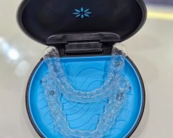 invisalign aligners