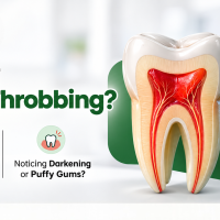 How Painful Is a Root Canal? What Patients Really Experience