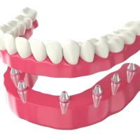 Top Qualities to Look for in the Best Dentist in Chandigarh